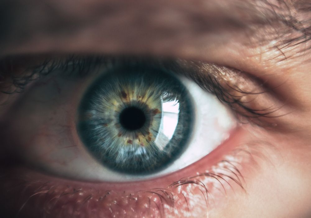 Squint Correction Surgery at Wills Eye, Agartala